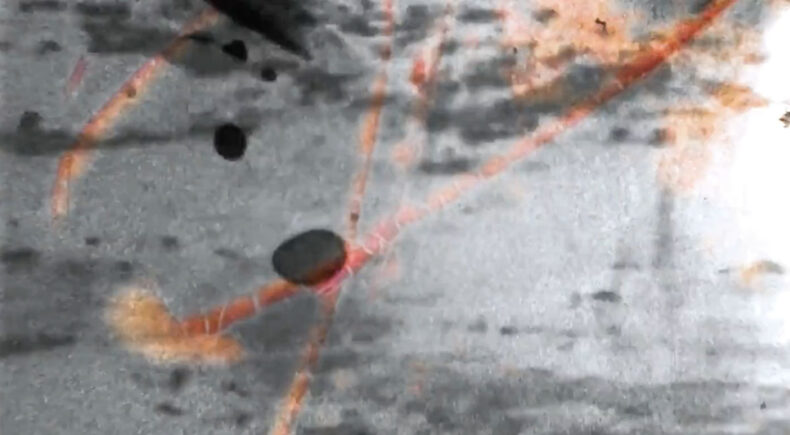 Menorrhagia - still #2