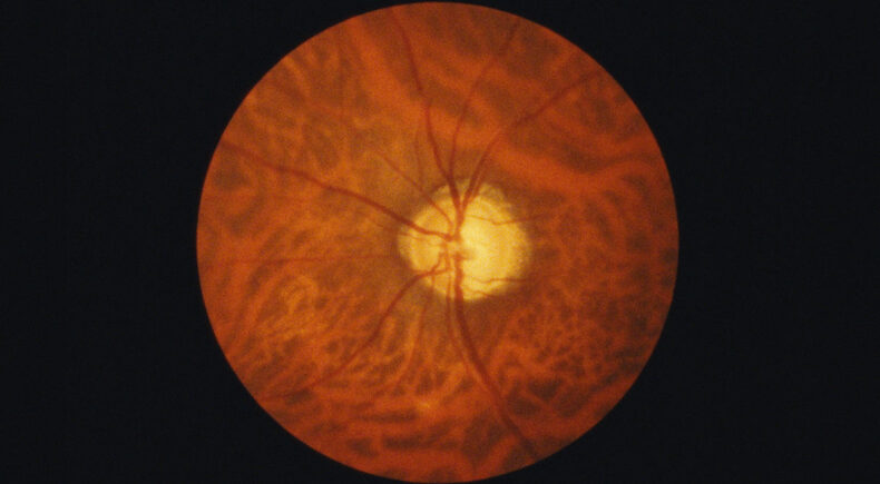 Immaculate Generations no. 1 - still #2