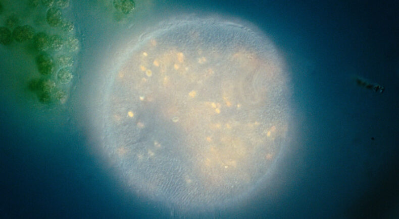 A Body Called Life - still #2