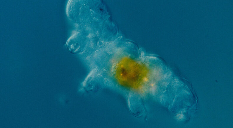 A Body Called Life - still #5